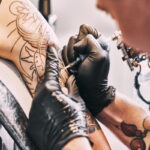 tattoo removal in Melbourne-d3ce9159