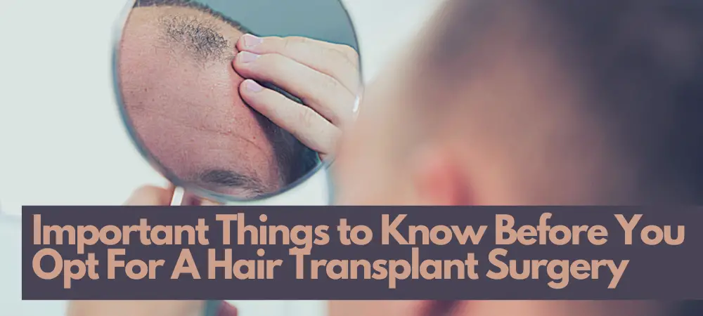 Important Things to Know Before You Opt For Hair Transplant Surgery-aeea6d0e
