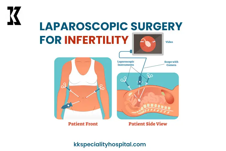 Laparoscopic surgery for infertility Banner-1f3f007a