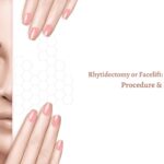 Rhytidectomy or Facelift What Is It, Its Types, Procedure & Recovery-06629de5