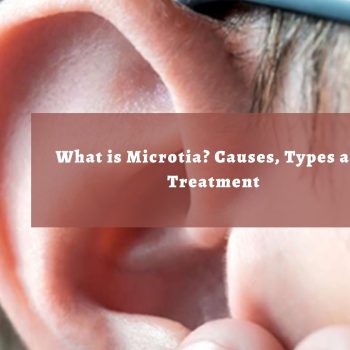 What is Microtia Causes, Types and Treatment-317c4904