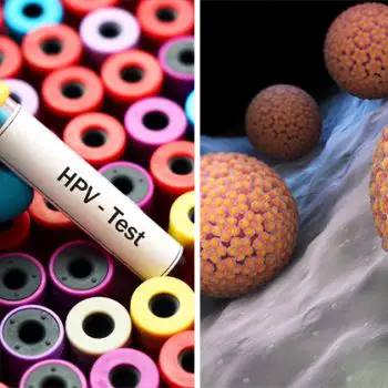 HPV and Pap Testing Market-26660e79