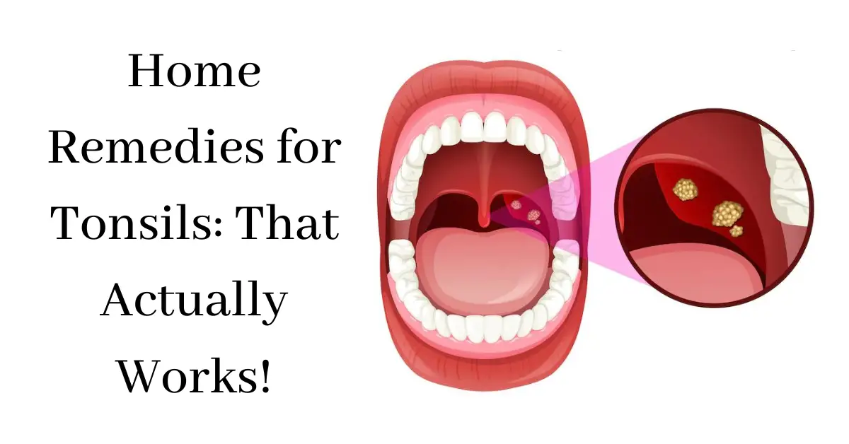 Home Remedies for Tonsils What Actually Works-aa630bf7