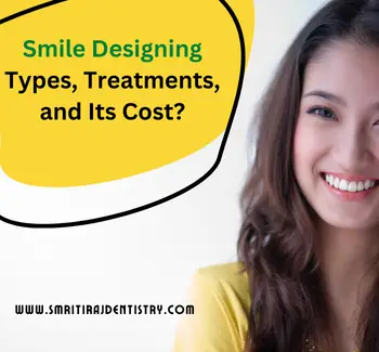 Smile Designing Types, Treatments, and Its Cost-9119d4eb