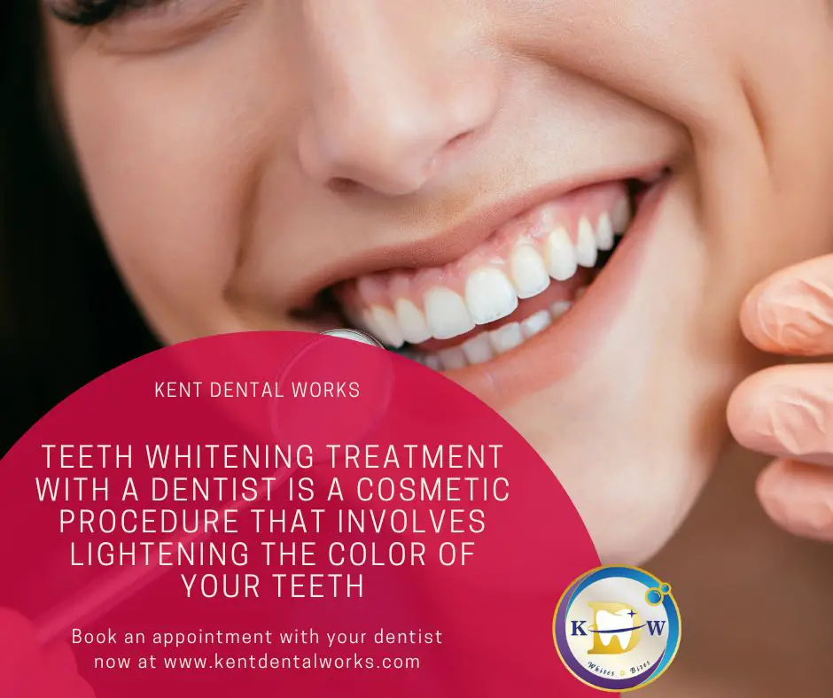 Teeth Whitening Singapore-d1ac684f