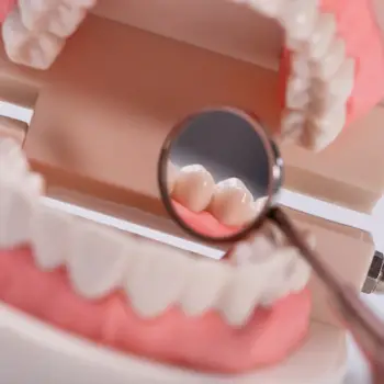 mini implant dentures tomball tx-f9d5c273
