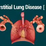 Interstitial Lung Disease Market-fe79d84a