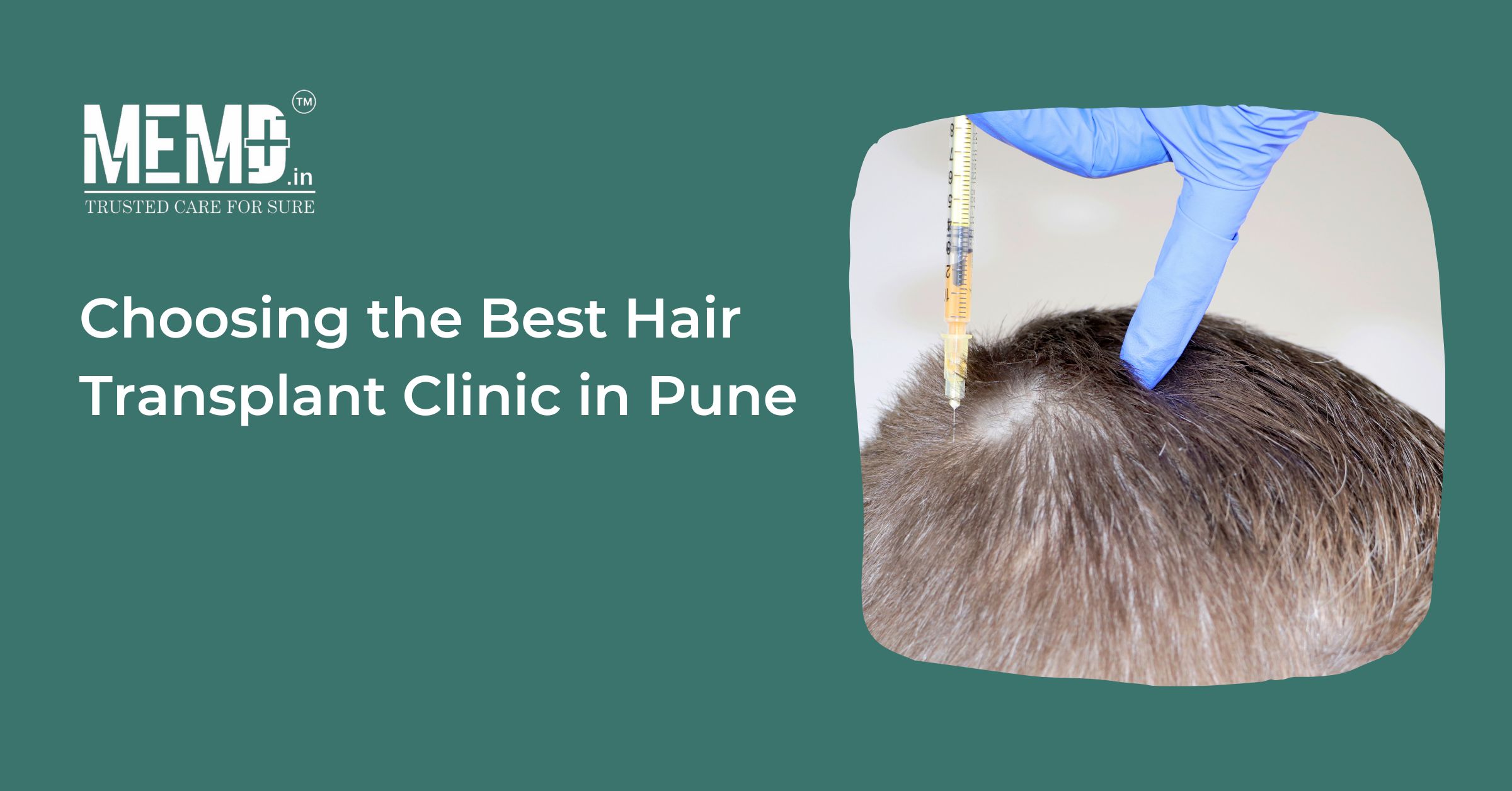 Choosing the Best Hair Transplant Clinic in Pune | MEMD HEALTHTECH