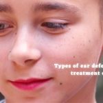 Types of ear deformities and treatment options-d774871b