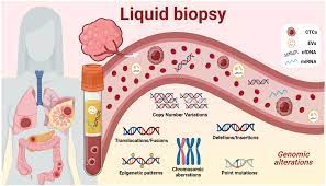 United States Liquid Biopsy Market-0ff2b4cd