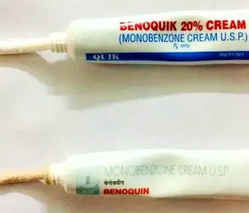 Benoquin Cream For Vitiligo Treatment