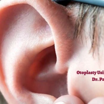 Otoplasty Using rib Cartilage by Dr. Parag Telang