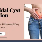 Pilonidal Cyst Infection (1)