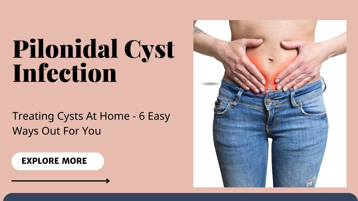 Pilonidal Cyst Infection (1)