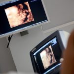 display-ultrasound-medical-consultation-470511-1024x682