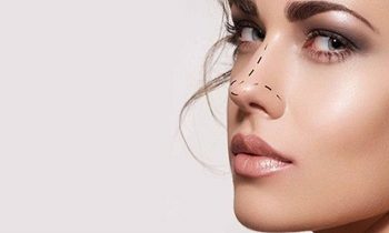 nose surgery cost in hyderabad