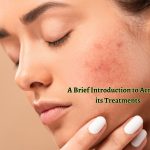 A Brief Introduction to Acne and its Treatments