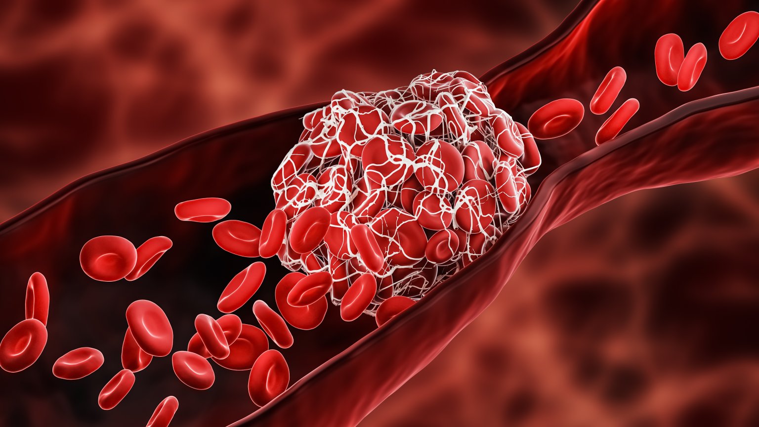 understanding-the-role-of-blood-clotting-factors-in-hemostasis