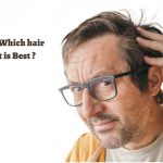 FUE or FUT Which hair transplant is Best