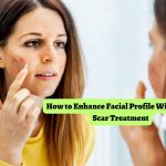How to Enhance Facial Profile With Acne Scar Treatment