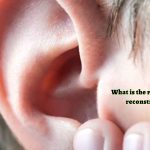 What is the right age to get ear reconstruction done