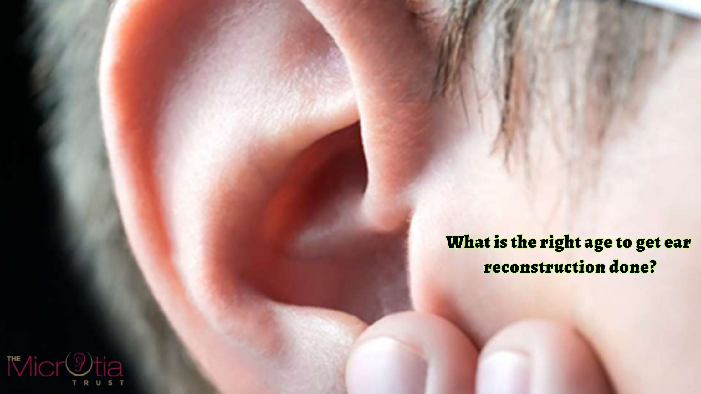 What is the right age to get ear reconstruction done