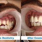 abf-Cosmetic-Dentistry