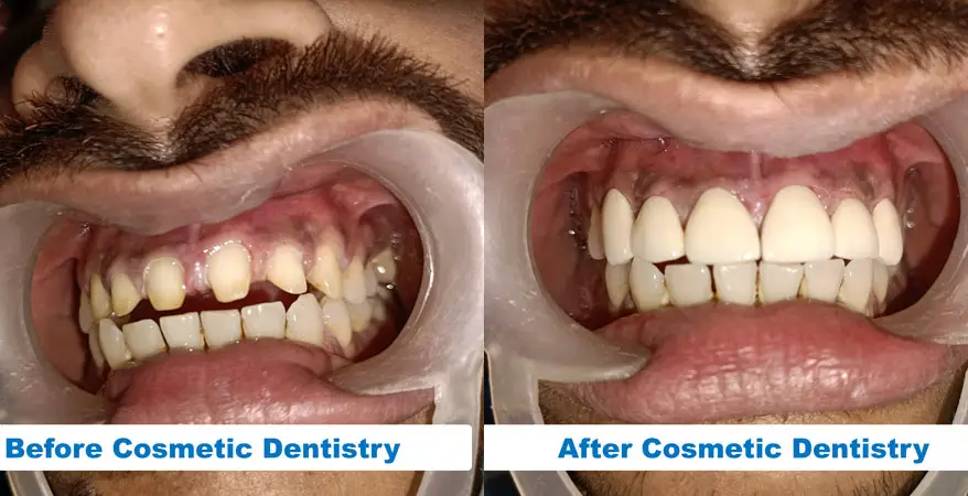 abf-Cosmetic-Dentistry