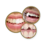 cosmetic_dentistry-500x500_c