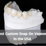 custom snap on veneers in the USA