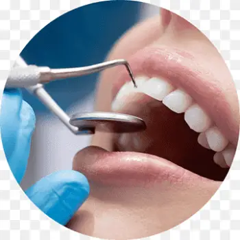 png-transparent-stainless-steel-dental-equipment-cosmetic-dentistry-dental-surgery-oral-hygiene-dental-implants-service-dentistry-lip-thumbnail