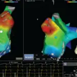 3D-Mapping-Images-For-Heart-Procedure-dr-siddhant-jain