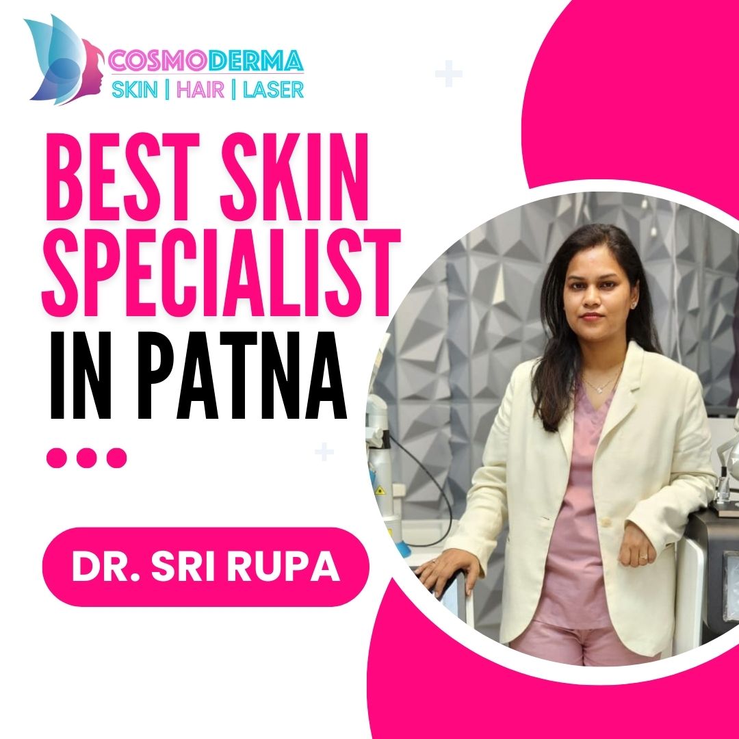 Best Skin Doctor In Patna