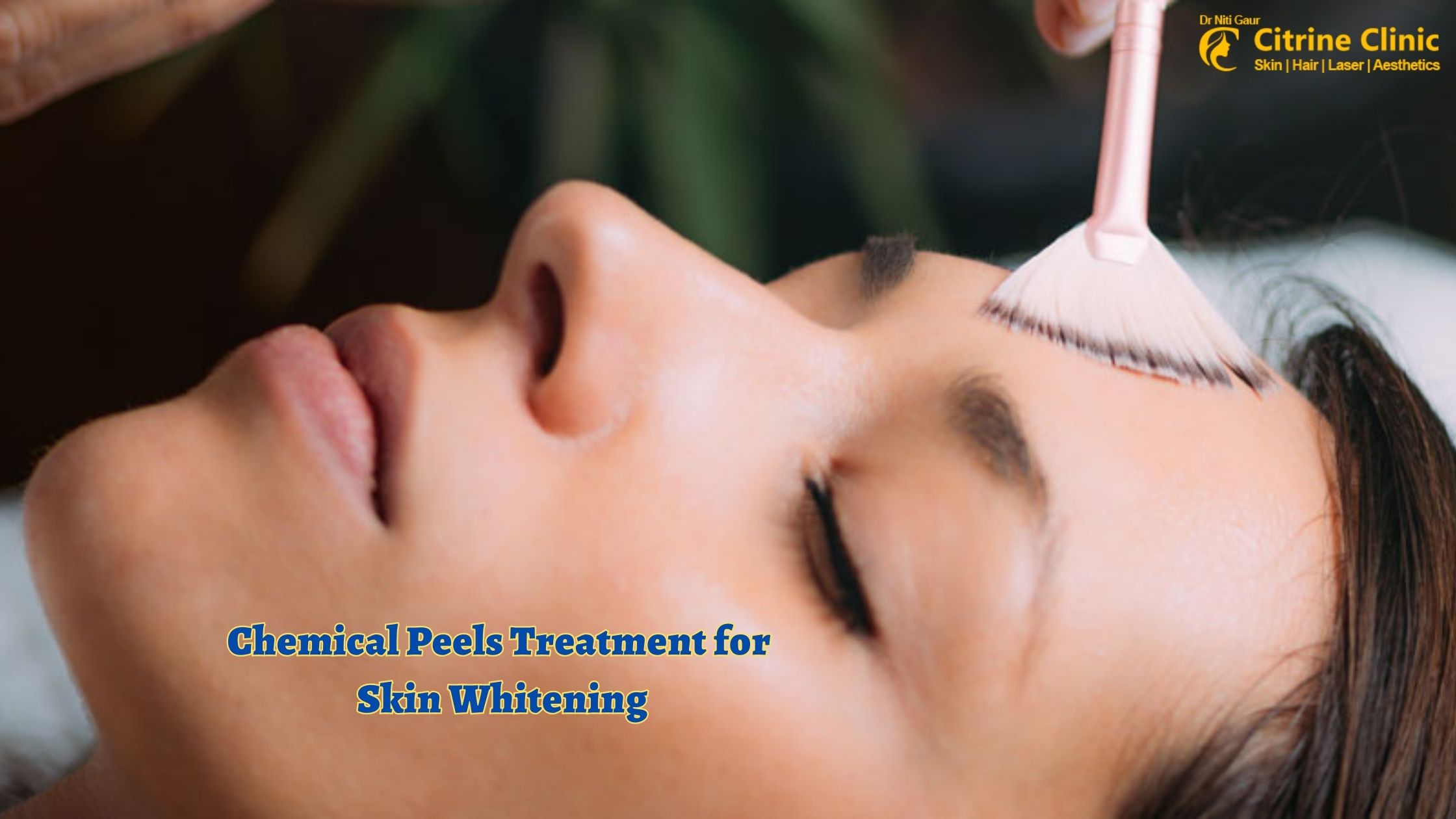 Chemical Peels Treatment for Skin Whitening