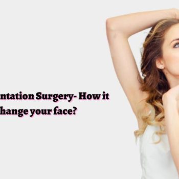 Chin Augmentation Surgery- How it can change your face