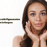 Get Glowing Skin with Pigmentation Treatment in Gurgaon