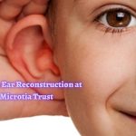 Get Microtia Ear Reconstruction at The Microtia Trust