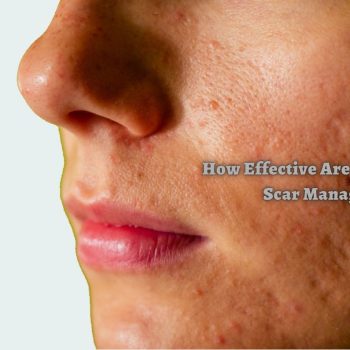 How Effective Are Lasers In Acne Scar Management