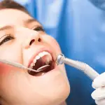 Root Canal in Dubai