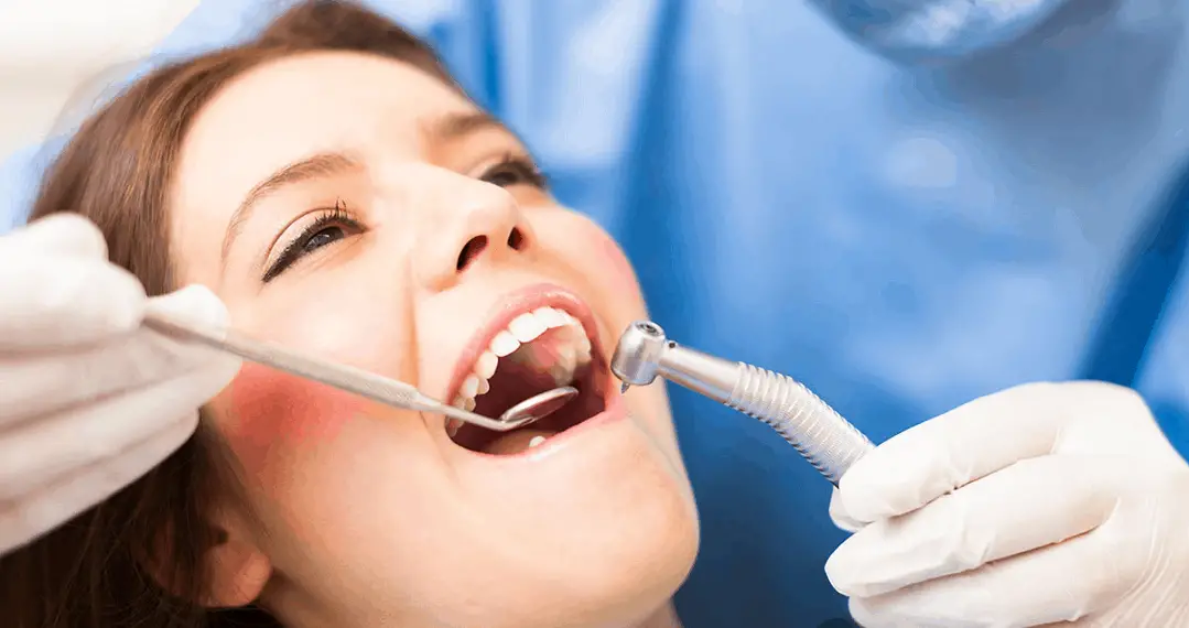 Root Canal in Dubai