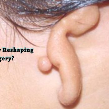 What is Ear Reshaping Surgery