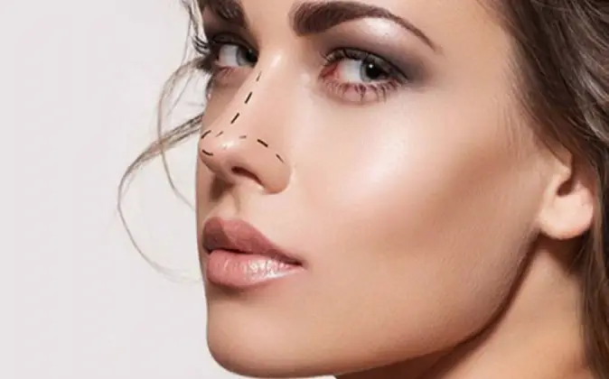 nose surgery cost in Hyderabad