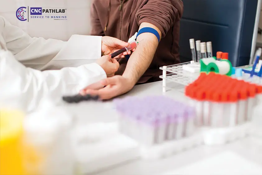 Get-Accurate-and-Convenient-Blood-Test-Results-with-Home-Collection