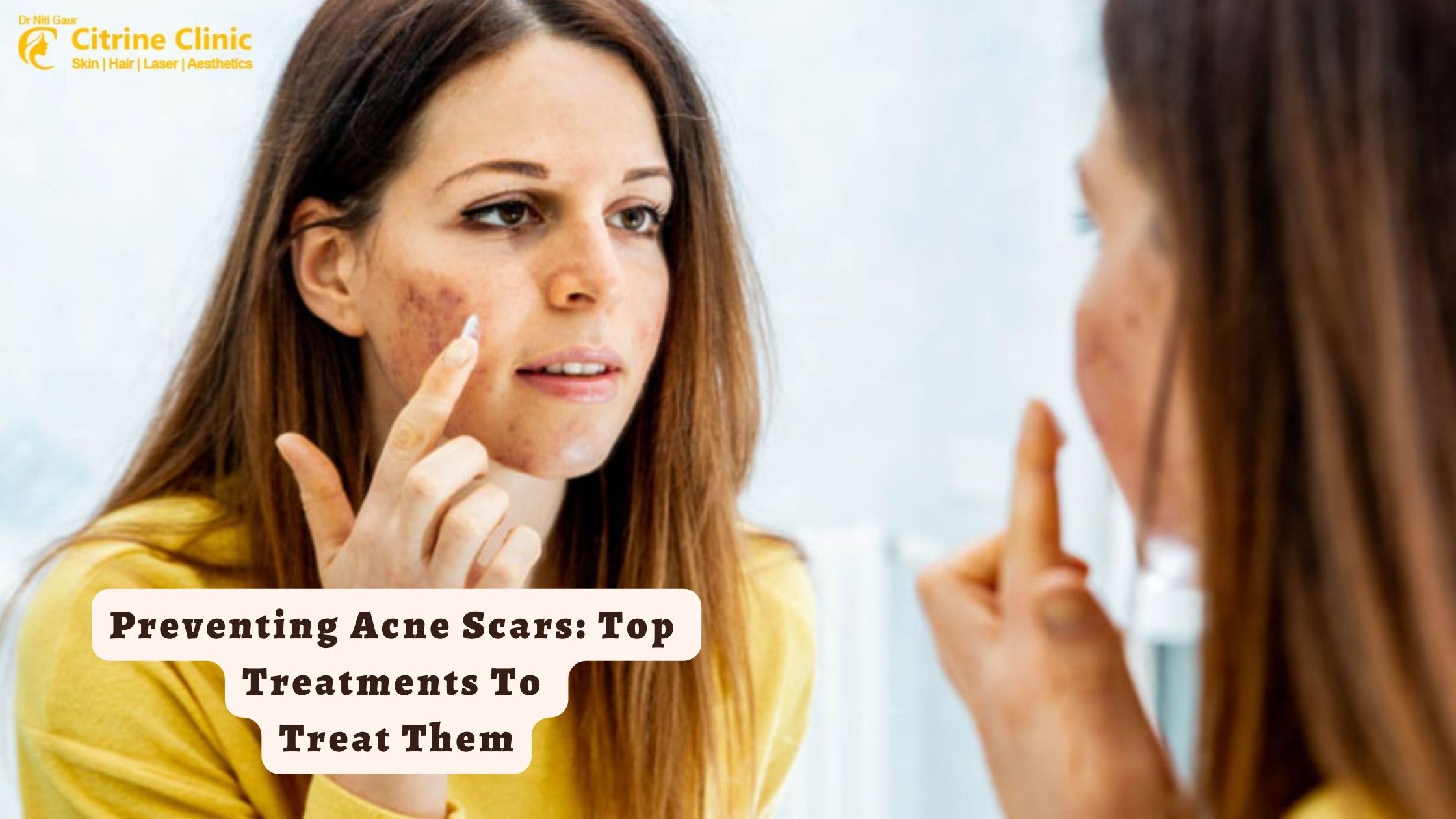 Preventing Acne Scars Top Treatments To Treat Them