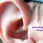 Protruding Ears Otoplasty Surgery Can Help!