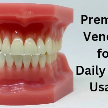 veneers for daily wear usage