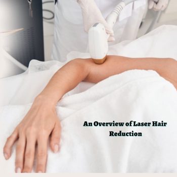 An Overview of Laser Hair Reduction (1)