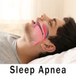 Apnea Sleep