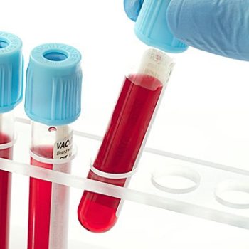Blood Transfusion Diagnostic Market