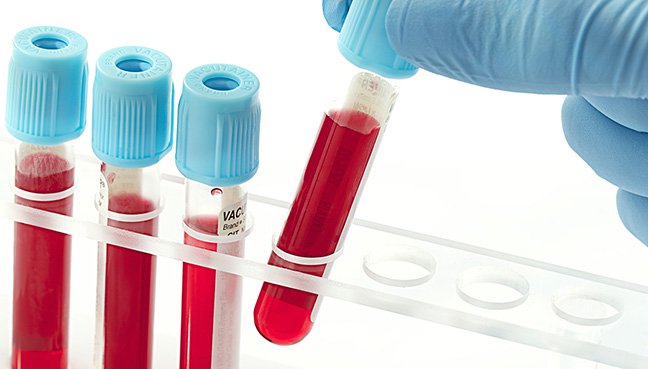Blood Transfusion Diagnostic Market